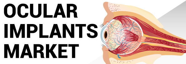 With A 5.7% CAGR, Ocular Implants Market 2023 Size Will Reach US - Suncoast News and Weather Sarasota Manatee & Charlotte